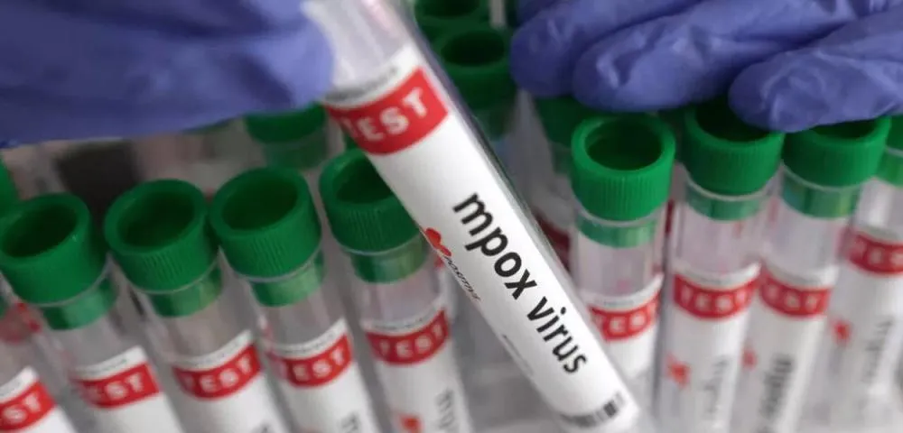 Mpox não é mais uma emergência, mas preocupações permanecem, diz OMS